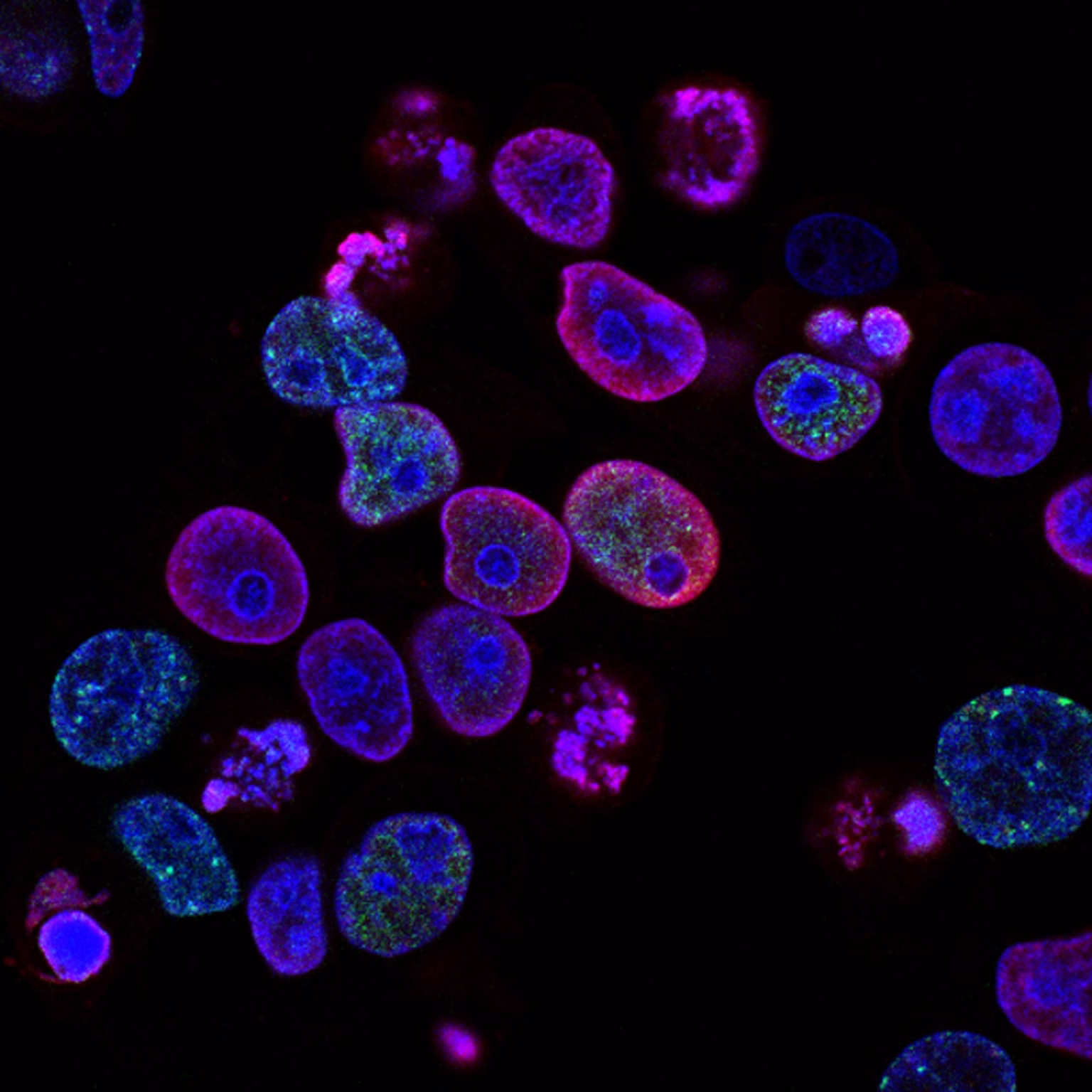 Investigadora trabajando en laboratorio, imagen asociada a biotecnología y nutrición de precisión.