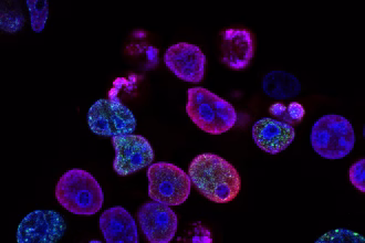 Investigadora trabajando en laboratorio, imagen asociada a biotecnología y nutrición de precisión.