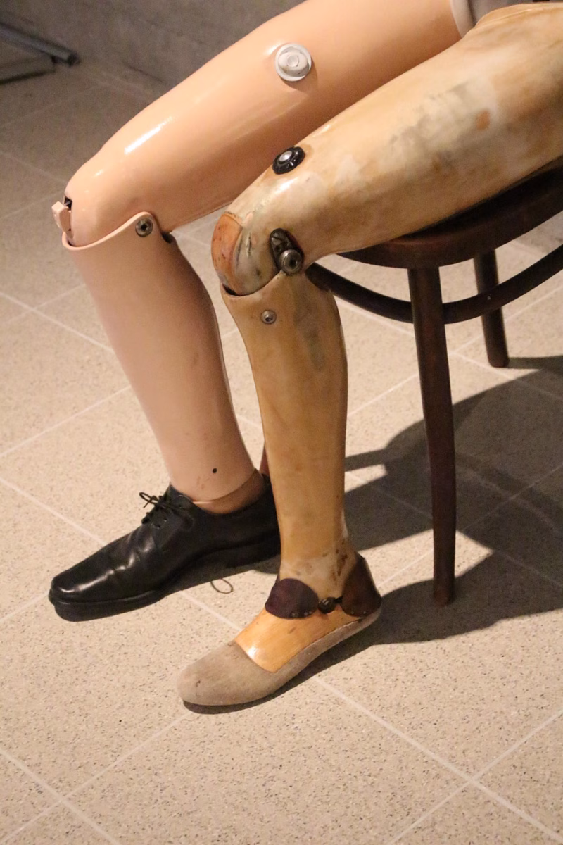 Pierna protésica junto a una pierna humana, imagen temática para robótica médica y rehabilitación.