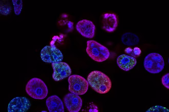 Investigadora trabajando en un laboratorio de biotecnología con muestras clínicas