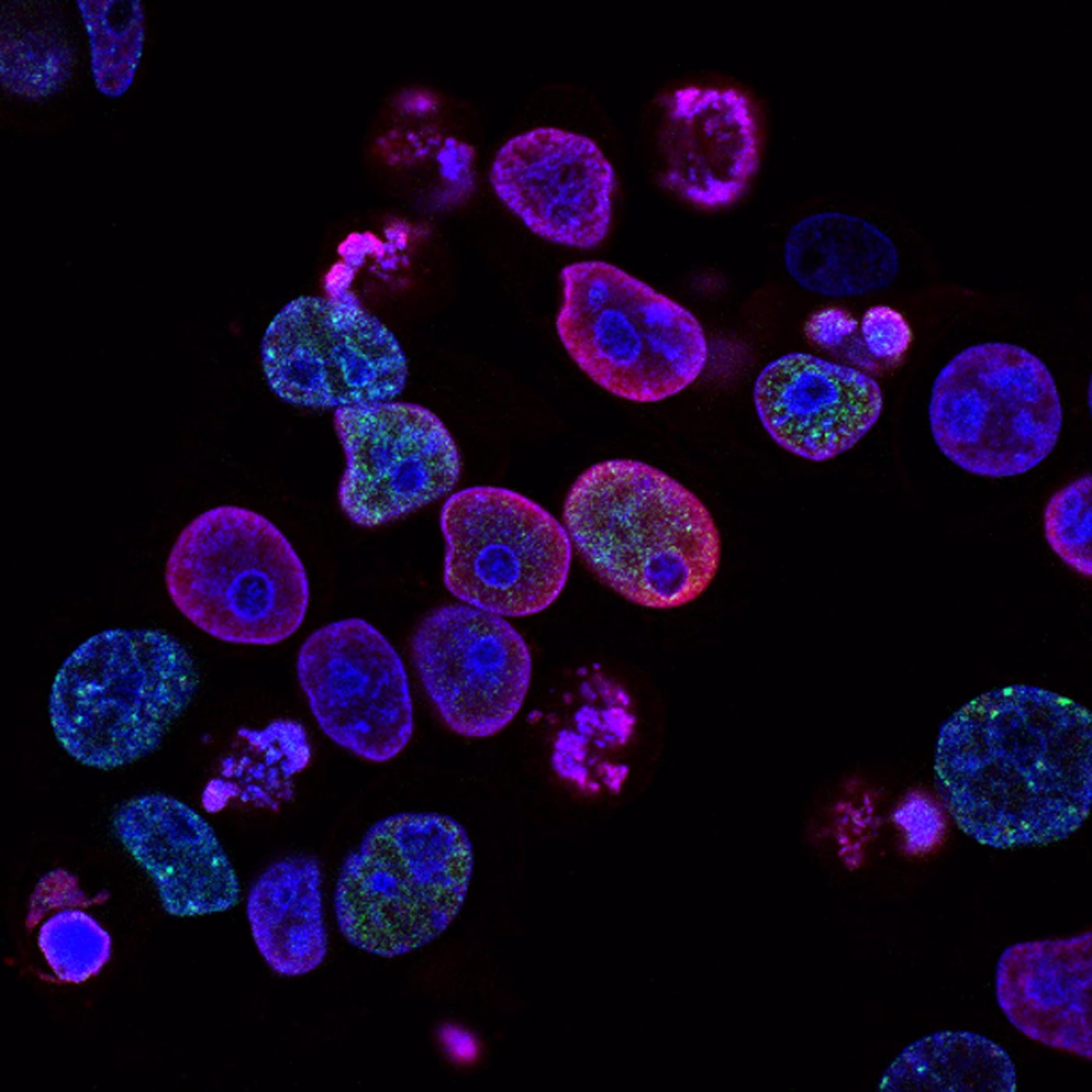 Investigadora trabajando en un laboratorio de biotecnología con muestras clínicas