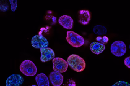 Investigadora trabajando con muestras en un laboratorio de biotecnología.